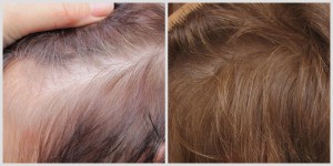 Haarverdichtung mit Pflanzenfarbe von Oliebe bei sensiblen, dünnen Haaren, vorher-nachher-Aufnahme